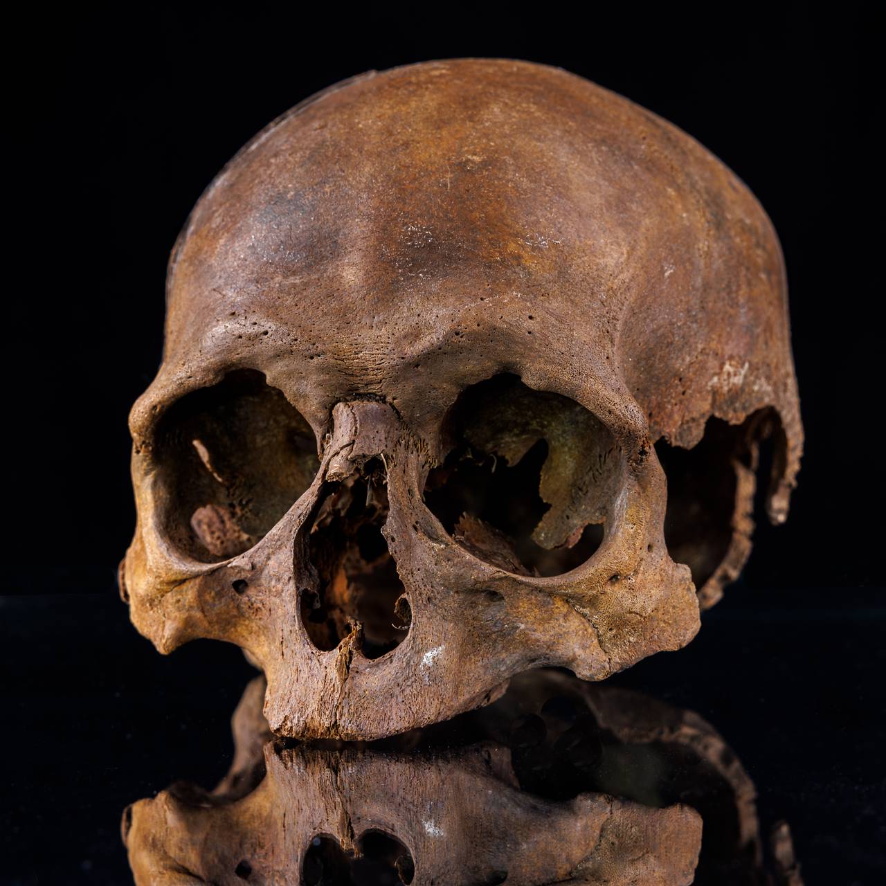 Von Bürgern, Söldnern und Chirurgen: Archäologie des Mittelalters und der frühen Neuzeit in Gifhorn